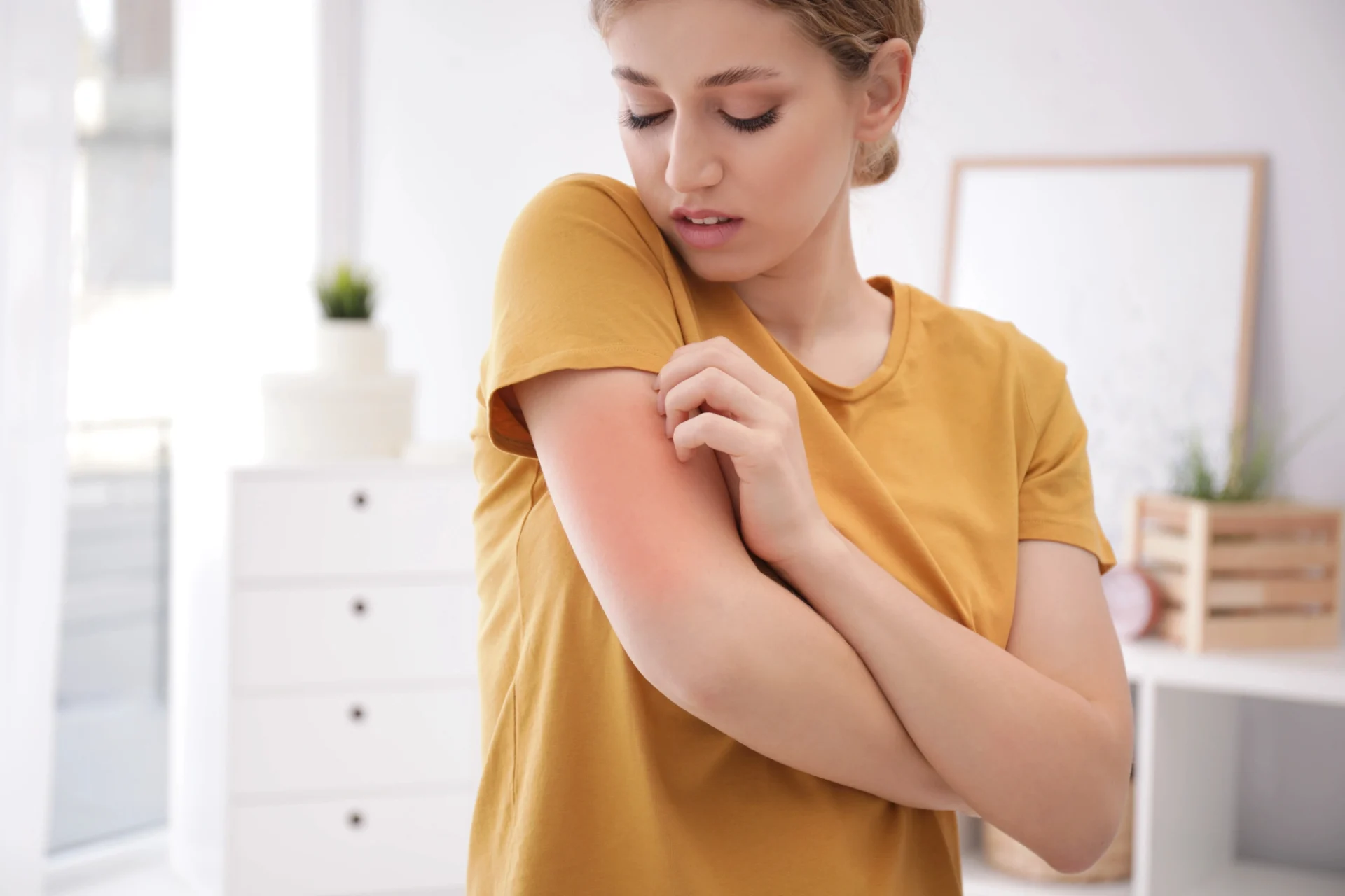 woman wearing a yellow t-shirt scratching a red rash on her arm